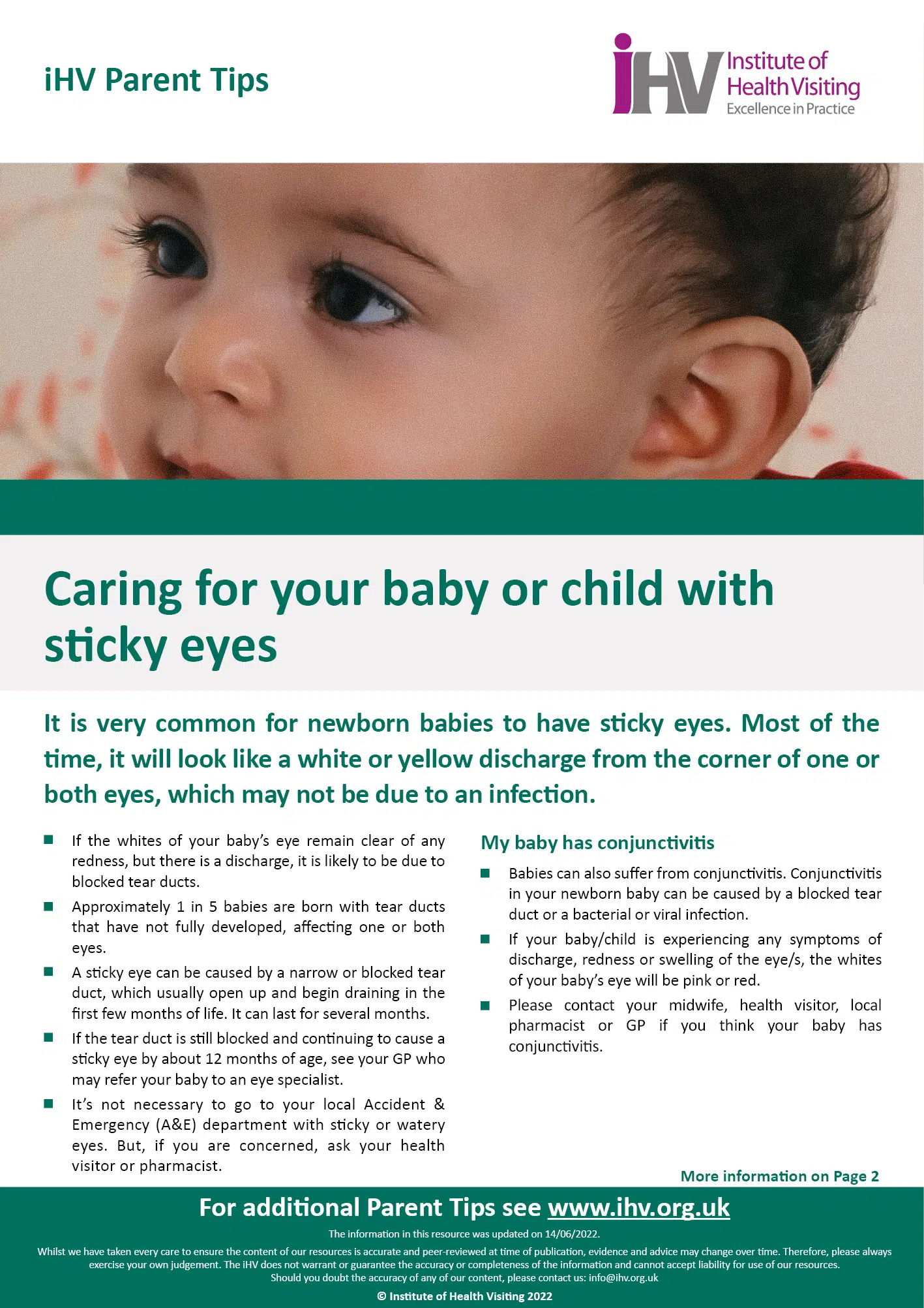 PT – Caring for baby or child with sticky eyes